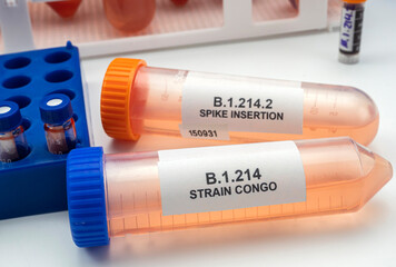 Laboratory analysis of a new Sars-Cov-2 mutation in Belgium from Congo, known as Spike Insertion...