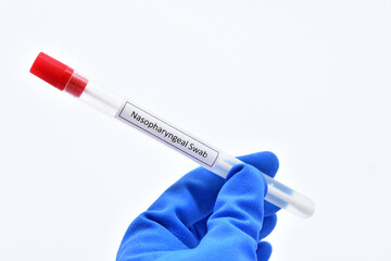 Test tube with nasopharyngeal swab from patient for COVID-19 testing by RT-PCR method 