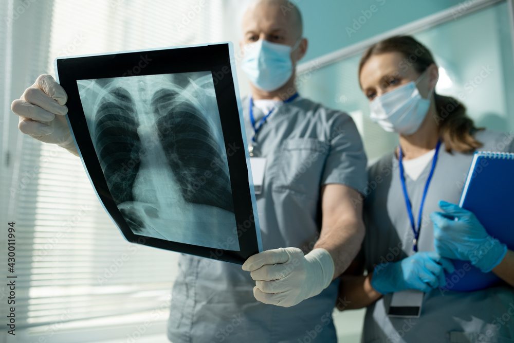 Aufkleber discussing lung x-ray image with assistant