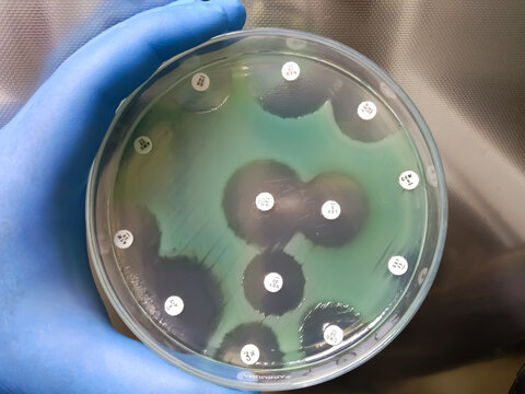 pseudomonas aeruginosa for susceptibility testing drug on mueller hinton agar plate in experiments microbiology hospital on white background.
