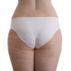 Woman with cellulite on white background, closeup - obrazy, fototapety, plakaty