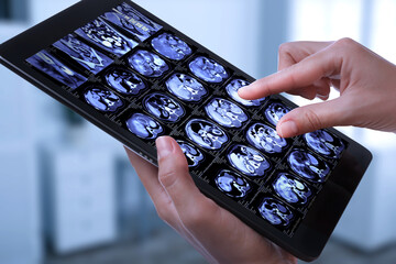 Doctor examining x-ray images on tablet indoors, closeup