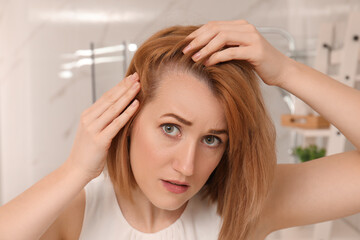 Fototapeta premium Sad woman suffering from baldness at home