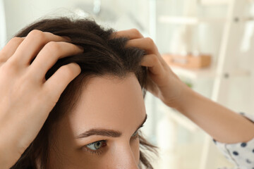 Naklejka premium Woman suffering from baldness at home, closeup