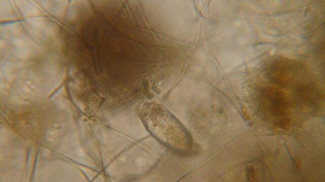 Bacteria Parasites and Worms in drinking Water under Microscope. nematode Worm under Microscope, Parasites Among Roundworms: Roundworms, Pinworms, Trichinella. Environmental Pollution.