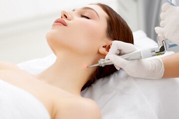 Cosmetologist removing mole with laser machine