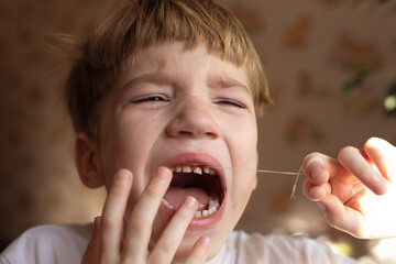 Portrait of boy upset by crying. Close-up of frustrated kid is sad and painful to remove baby teeth, screaming in pain.