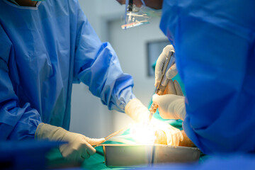 Close up of male orthopedic doctor And the assistant team is working Orthopedic doctors are doing...