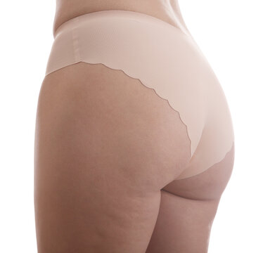 Woman with cellulite on white background, closeup