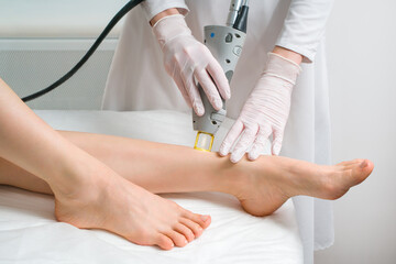 The procedure for removing hair on the body of a woman in a cosmetology clinic. Laser hair removal.