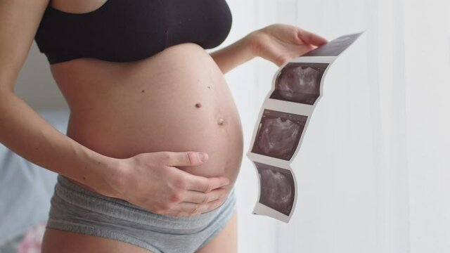 Pregnant female touching her belly and watching ultrasound photo of baby embryo.