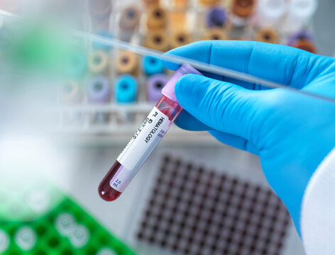 UK, Buckinghamshire, High Wycombe, Scientist holding hematology test vial
