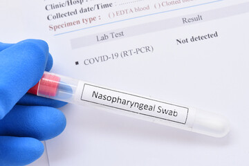 COVID-19 not detected result, laboratory report of COVID-19 testing by using RT-PCR method, the result showed not detected or negative