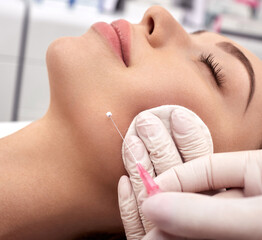 Woman receives a facelift, procedure mesothreads lifting skin. Cosmetic surgery, meso-threads lift,...