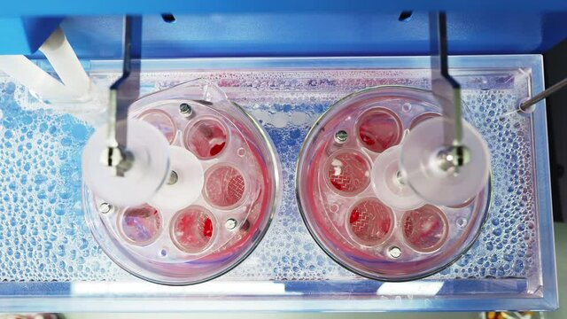 Top View Of Dissolution Apparatus For Pills At Medical Laboratory Moving In Liquid. Chemical Analysis Of Medicine Composition. Control Of Quality And Safety. Pharmaceutical Equipment.