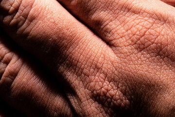 Naklejka premium Photo showing super detailed skin texture. Fingers macro photography. High-resolution image.