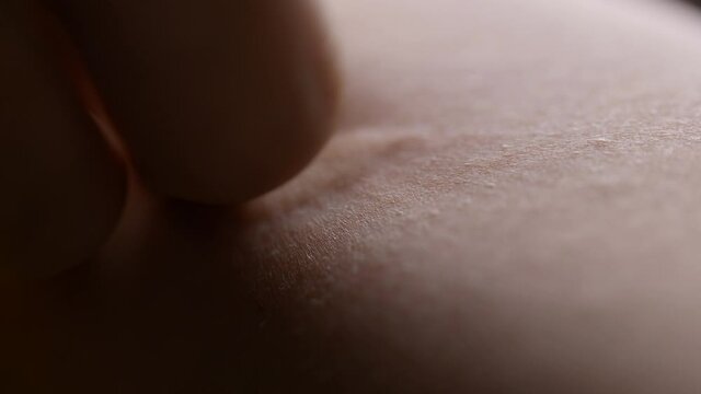 Person scratching at itchy skin on their arms - closeup