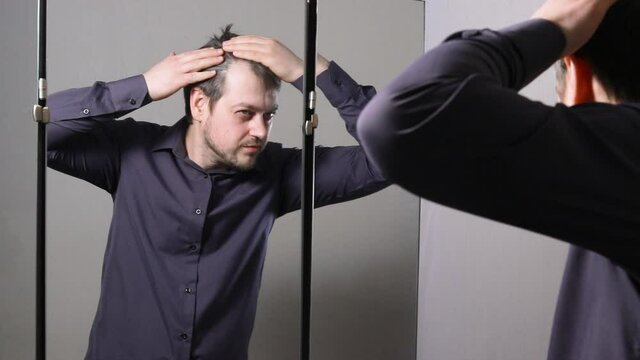 A 35-year-old young man looks in the mirror and touches his hair, reveals a receding hairline, a high temple, a high forehead, no hair on the forehead. Early male pattern baldness.