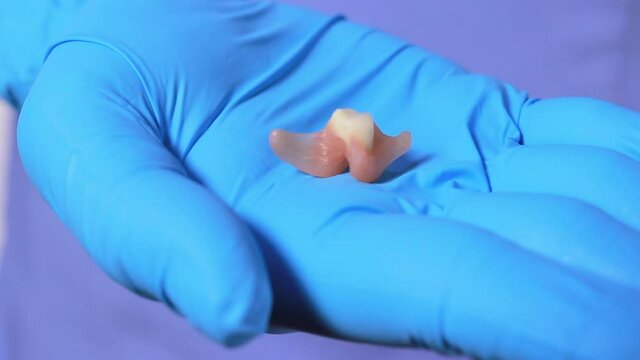 Dentist holding ceramic artificial false unit tooth. Dental prosthesis in gloved hands of the doctor close-up. Dentistry conceptual photo. Prosthetic dentistry. False teeth