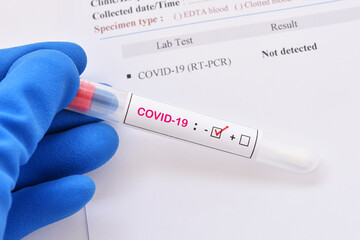 Nasopharyngeal swab not detected with COVID-19 test by using RT-PCR method