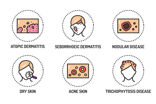 Skin diseases color line icons set. Isolated vector element. Outline pictograms for web page, mobile app, promo