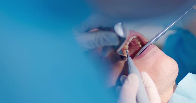 Close-up an Arabian male patient with an optragate and wearing disposable eyeglasses is laying in the dental chair and having teeth cleaning procedure by the dentist.
