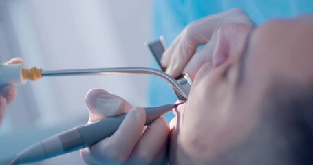 Close-up a male patient is having teeth cleaning by the dentist who is using dental tools. 
