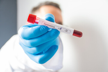 Coronavirus or COVID-19 diagnosis concept photo. Doctor holding laboratory test tube with blood with COVID-19 paper on it and marked with positive result, which means that patient is sick coronavirus 