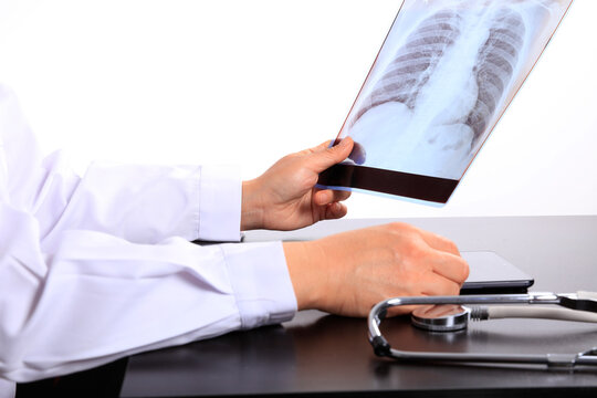 Medical doctor looking at x-ray picture of lungs in hospital. Covid-19 consept