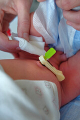 mother in the hospital doing umbilical cord care for her 1-day-old child - obrazy, fototapety, plakaty