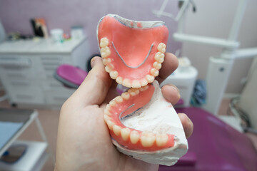 complete removable dental prostheses on gypsum models