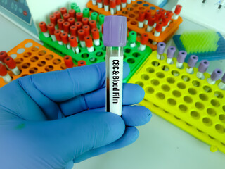Blood sample in lavender tube for CBC and Blood Film test at hematology laboratory in medical...
