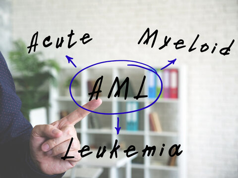 Written phrase AML Acute Myeloid Leukemia . Hand gestures - man pointing on virtual object on background.