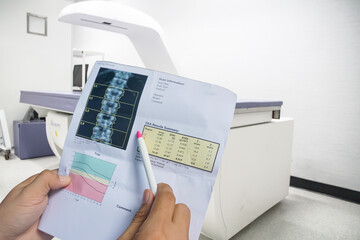 (BMD) DEXA densitometry spine scan. Osteopenia present, frequent precursor to osteoporosis on pen point on Bone density machine background .Medical healthcare concept. - obrazy, fototapety, plakaty