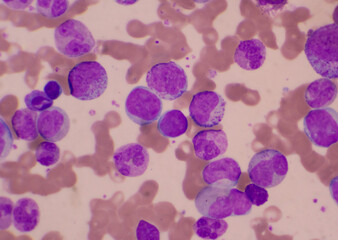 Mixed stage white blood cell on red cells background.