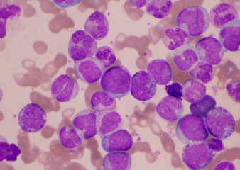 Mixed stage white blood cell on red cells background.