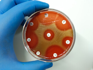 Antimicrobial susceptibility testing in petri dish : Streptococcus pyogenes (Group A Streptococci),...