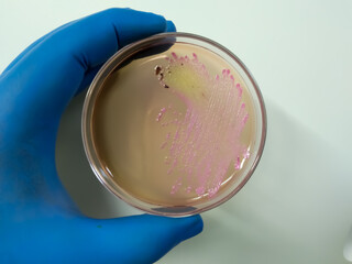 Salmonella colonies on ss agar, salmonella black colonies, Enterobacteriaceae, Microbiology