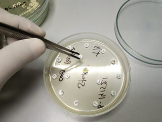 Scientist or microbiologist place antibiotic disk, diagnosis for antibiotic resistance of...