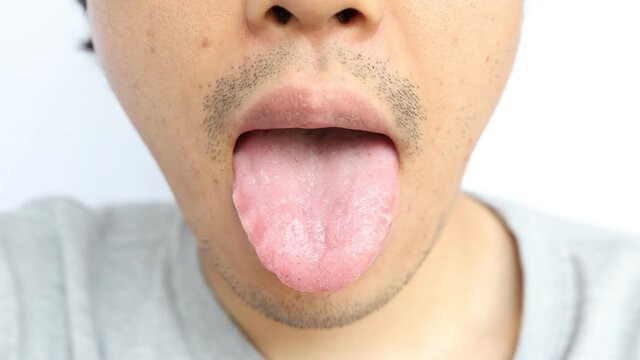 アジア人男性の舌