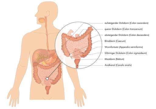 Verdauungsorgane / Verdauungssystem des Menschen - Dickdarm - deutsche Beschriftung