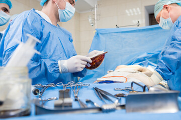 Breast augmentation under the guidance surgeons team in surgical operating room.