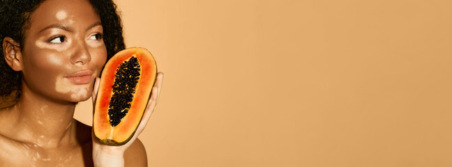 Woman with vitiligo has papaya in her hands, beige background. Concept of moisturizing and pampering skin with papaya cream