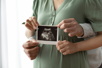 Crop close up of happy young multiethnic future parents hold ultrasound picture of baby. Diverse...