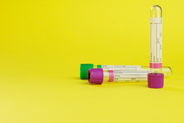 vacuum tubes for collection and blood samples on yellow background..Transparent with purple and...