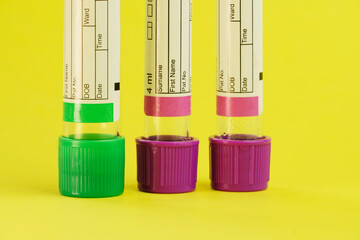 vacuum tubes for collection and blood samples on yellow background..Transparent with purple and...