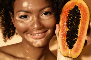 Portrait of African American woman with vitiligo with papaya near her face, close-up. Moisturizing...