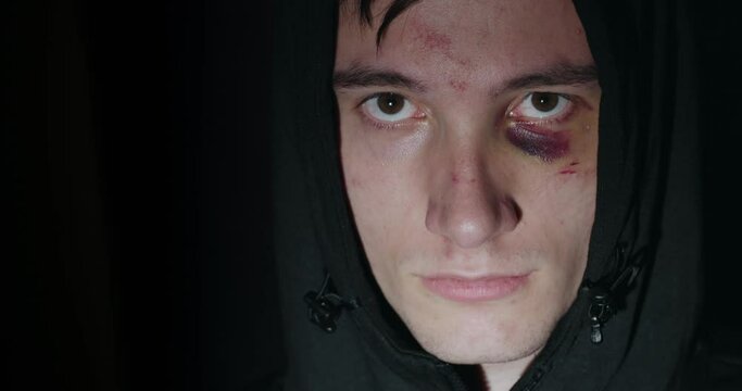 Portrait of a beaten young man with a bruise under his eye