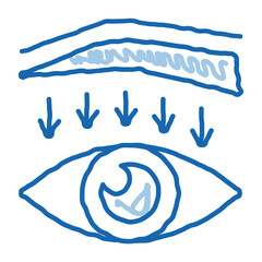 Fototapeta premium eyebrow down surgery doodle icon hand drawn illustration