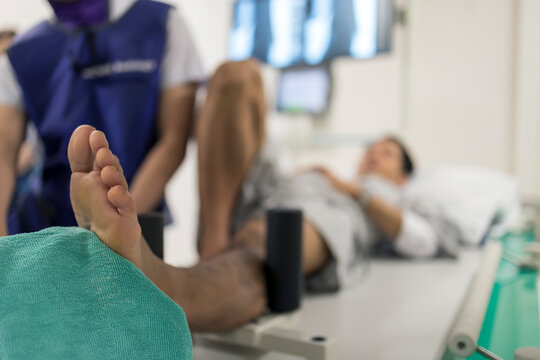 Selective focus with blurred.Doctor using stress test in ankle instability patient with chronic ankle sprain.The force was apply before radiographic study.